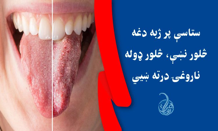 ستاسې پر ژبه دغه څلور نښې، څلور ډوله ناروغۍ درته ښيي 